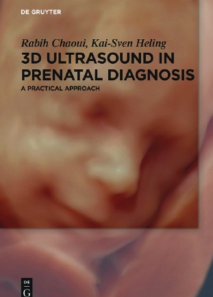 3D Ultrasound in Prenatal Diagnosis PDF