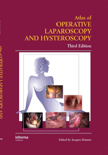 Atlas of Operative Laparoscopy and Hysteroscopy PDF