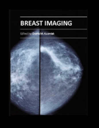 Breast Imaging PDF