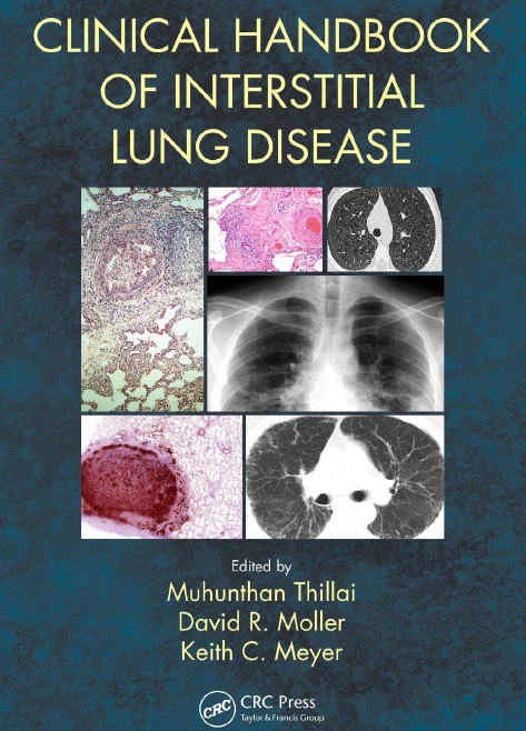 Clinical Handbook of Interstitial Lung Disease PDF