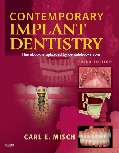 Contemporary Implant Dentistry 3rd Edition PDF