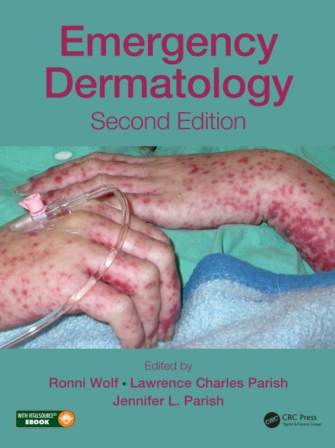 Emergency Dermatology PDF