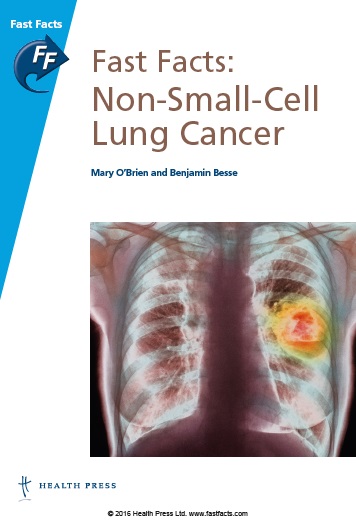 Fast Facts Non-Small-Cell Lung Cancer PDF