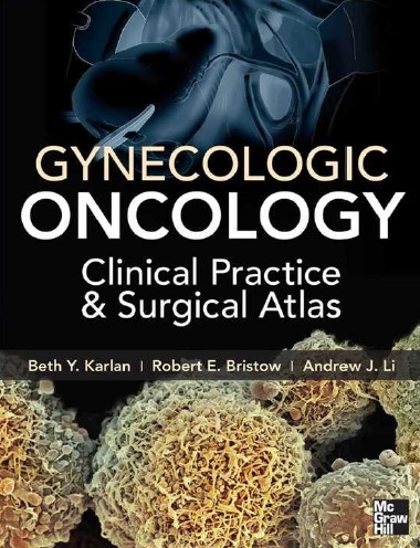 Gynecologic Oncology PDF