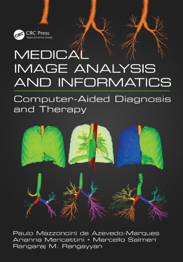 Medical Image Analysis and Informatics PDF