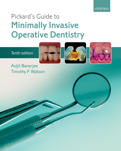 Pickard's Guide to Minimally Invasive Operative Dentistry PDF