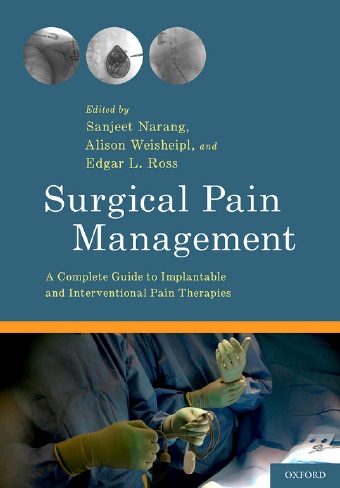 Surgical Pain Management PDF