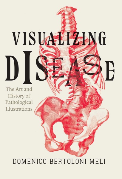 Visualizing Disease PDF