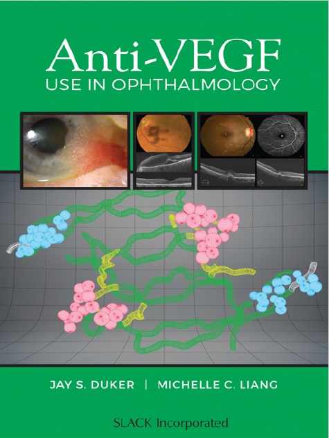 Anti-VEGF Use in Ophthalmology PDF