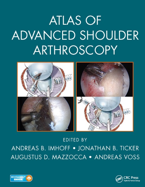 Atlas of Advanced Shoulder Arthroscopy PDF