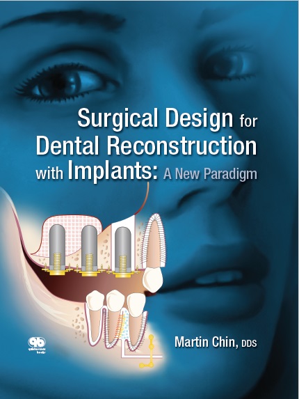 Surgical Design for Dental Reconstruction with Implants PDF
