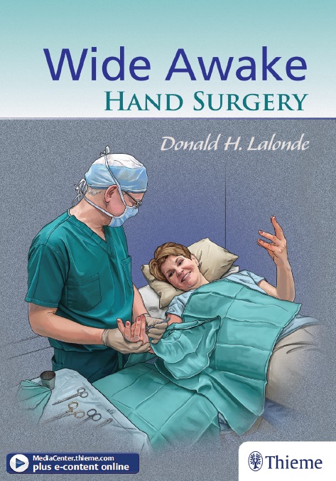 Wide Awake Hand Surgery PDF
