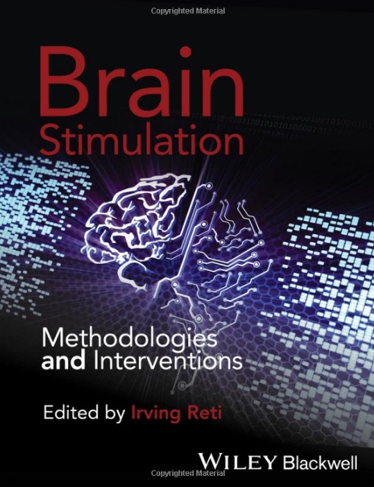 Brain Stimulation PDF