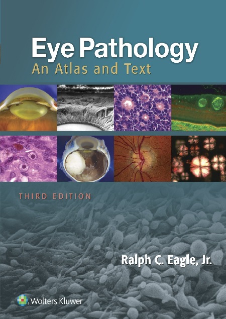 Eye Pathology An Atlas and Text PDF