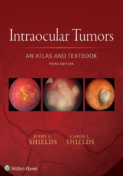 Intraocular Tumors An Atlas and Textbook PDF