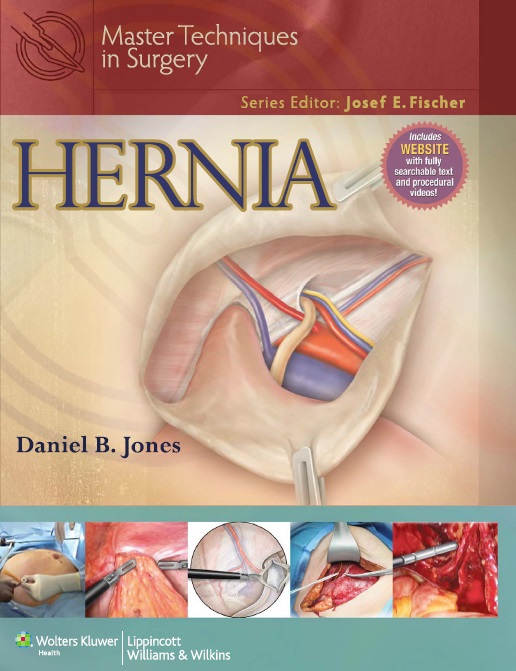 Master Techniques in Surgery: Hernia PDF