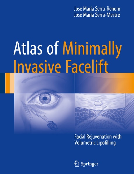 Atlas of Minimally Invasive Facelift PDF