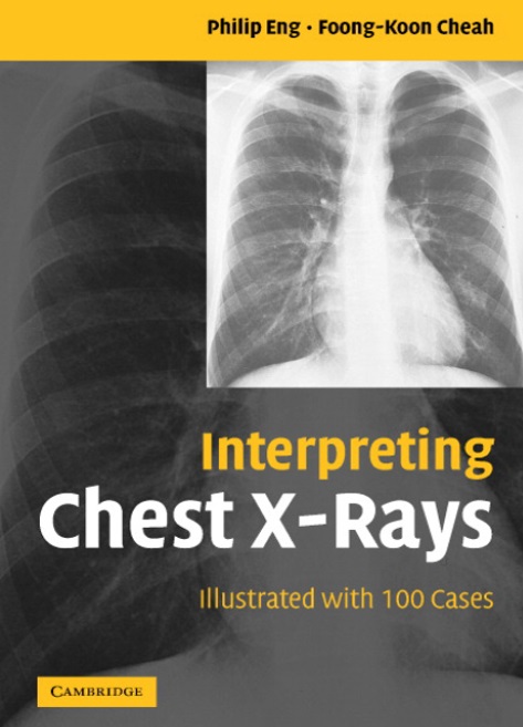 Interpreting Chest X-Rays PDF