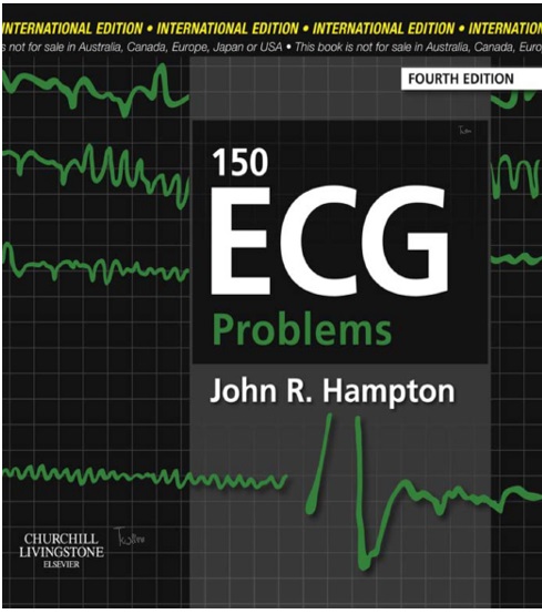 150 ECG Problems 4th Edition PDF