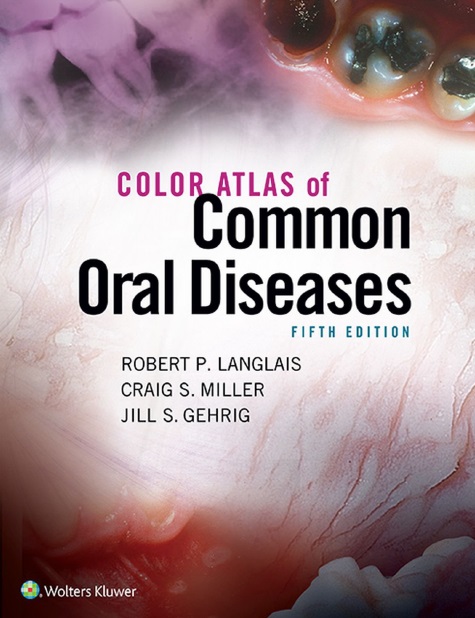 Color Atlas of Common Oral Diseases PDF