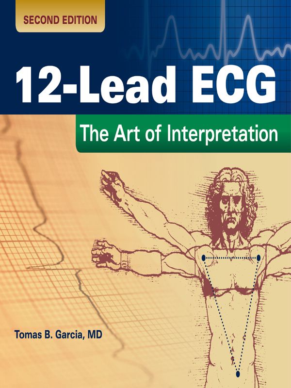 12-Lead ECG: The Art of Interpretation 2nd Edition PDF
