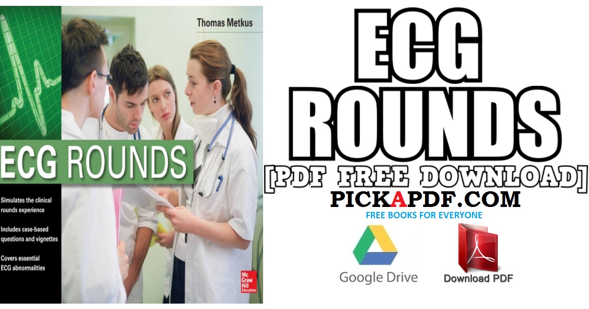ECG Rounds (Cardiology) PDF