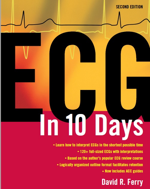 ECG in Ten Days 2nd Edition PDF