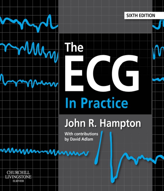 The ECG In Practice 6th Edition PDF
