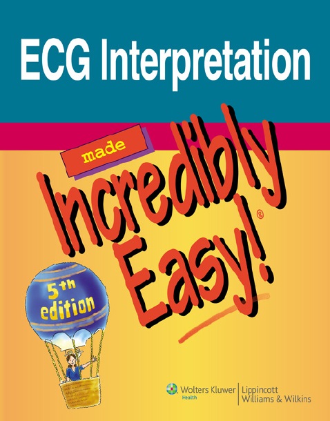 ECG Interpretation Made Incredibly Easy! PDF