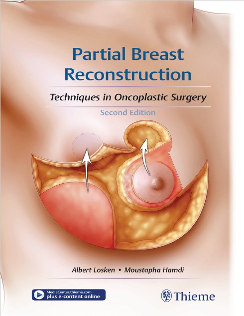 Partial Breast Reconstruction: Techniques in Oncoplastic Surgery PDF