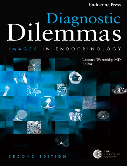 Diagnostic Dilemmas: Images In Endocrinology PDF