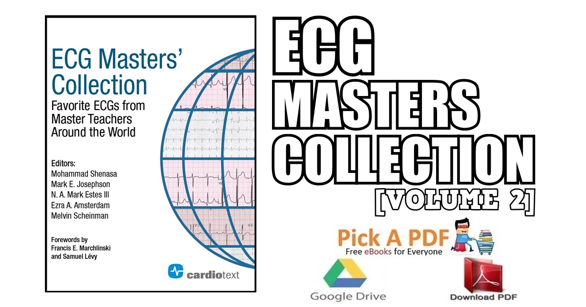 ECG Masters Collection PDF