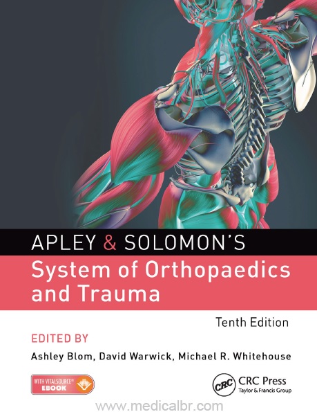 Apley & Solomons System of Orthopaedics and Trauma 10th Edition PDF