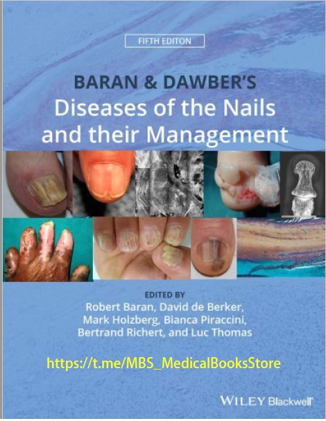 Baran and Dawber's Diseases of the Nails and their Management 5th Edition PDF