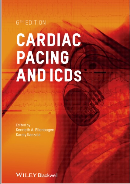 Cardiac Pacing and ICDs 6th Edition PDF