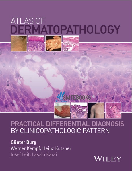 Atlas of Dermatopathology PDF