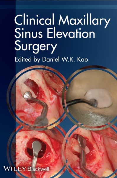 Clinical Maxillary Sinus Elevation Surgery PDF