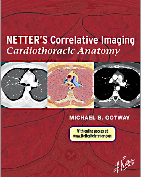 Netter's Correlative Imaging Cardiothoracic Anatomy PDF