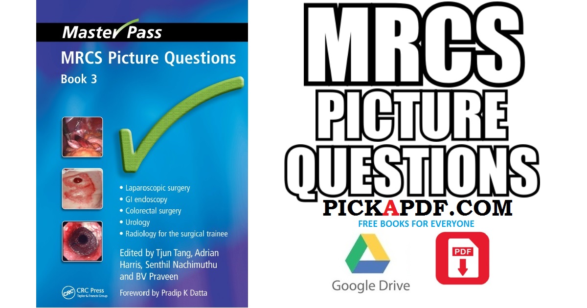 MRCS Picture Questions PDF