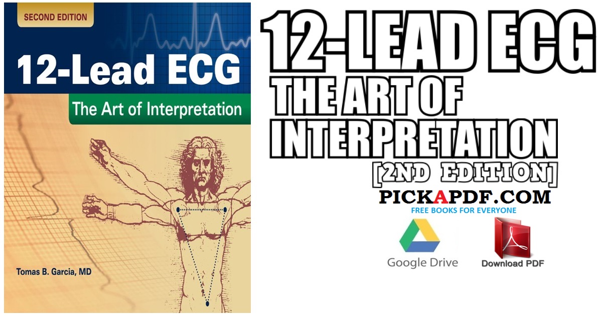 12-Lead ECG- The Art of Interpretation