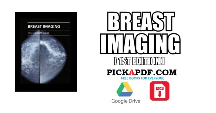 Breast Imaging PDF