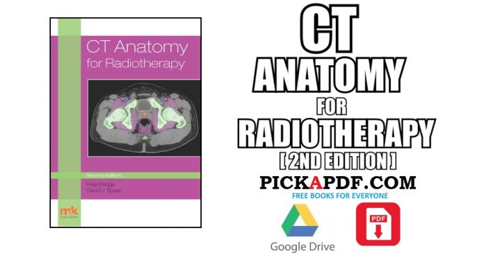 CT Anatomy for Radiotherapy PDF
