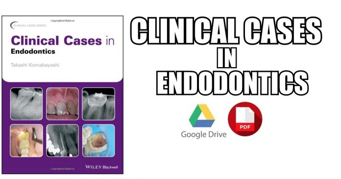 Clinical Cases in Endodontics PDF