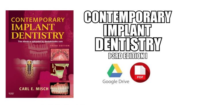 Contemporary Implant Dentistry 3rd Edition PDF