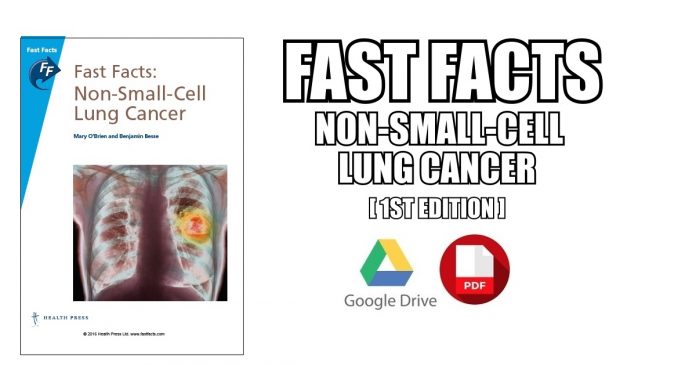 Fast Facts Non-Small-Cell Lung Cancer PDF
