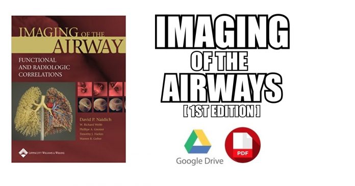 Imaging of the Airways PDF