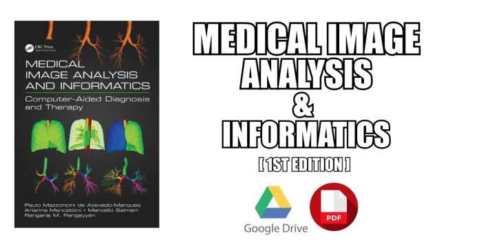 Medical Image Analysis and Informatics PDF
