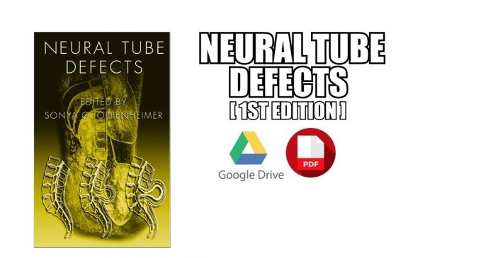 Neural Tube Defects PDF