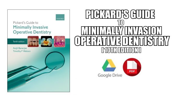 Pickard's Guide to Minimally Invasive Operative Dentistry PDF