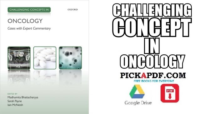 Challenging Concepts in Oncology PDF